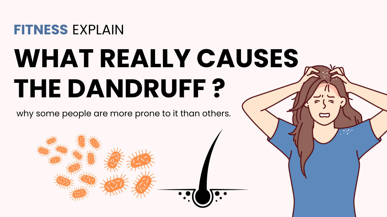 Read more about the article What Really Causes the dandruff ?